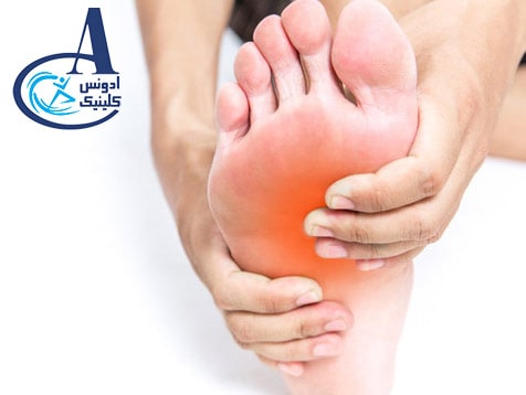 ادونس کلینیک  - مستیل مربوط به علت درد کف پا در سالمندان