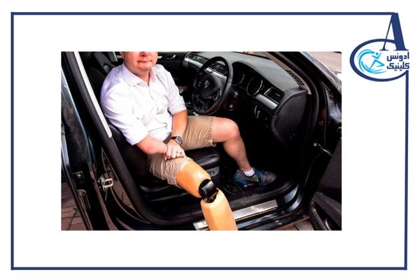 رانندگی با پروتز پا